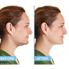 Portable Neck Slimmer